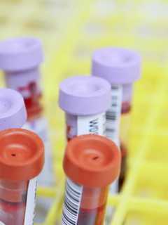 Rutherford Residents Can Get Low-Cost Blood Screening
