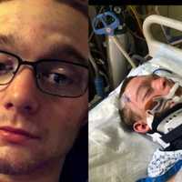 <p>Firefighter Joey Hyatt, a member of the North Highlands Fire Department in Cold Spring was in an accident last year.</p>