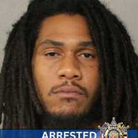 Sheriff's Deputy Treated For Concussion, Cuts After Man Resists Arrest In Maryland