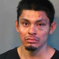 Long Island Man Kicked, Spit On Cops, Leading To Hospitalizations Of Two Officers, Police Say