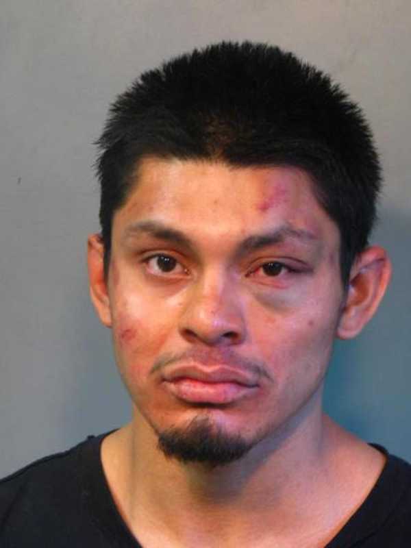 Long Island Man Kicked, Spit On Cops, Leading To Hospitalizations Of Two Officers, Police Say