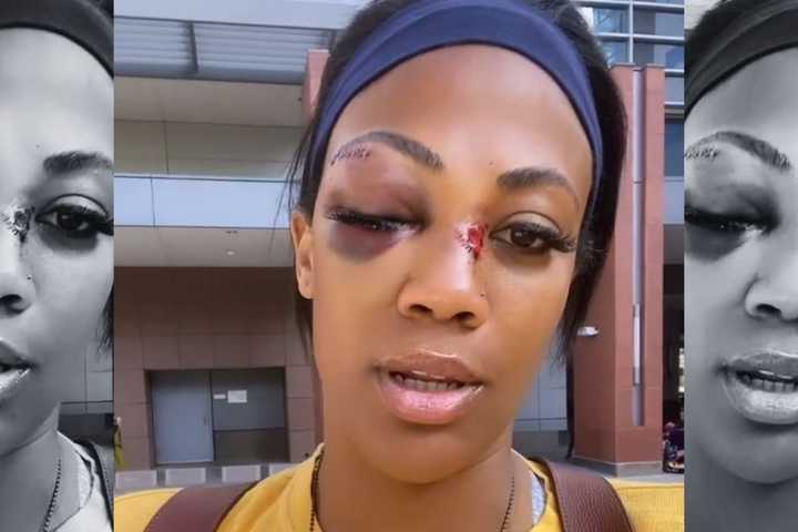 Ex-Olympian From PA Blinded After Jumped By Homeless Man (VIDEOS)