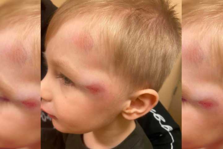 4-Year-Old 'Almost Died' In Halloween Hit-Run, Pennsylvania Mom Says