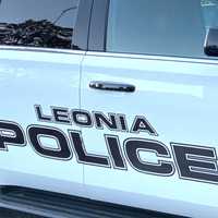 Woman Walking Dog Pinned Under Car Driven By Man, 84, In Leonia: Police