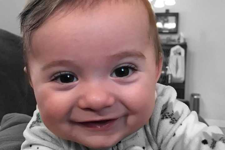 Ridgefield Park Baby Smiles Through Pain