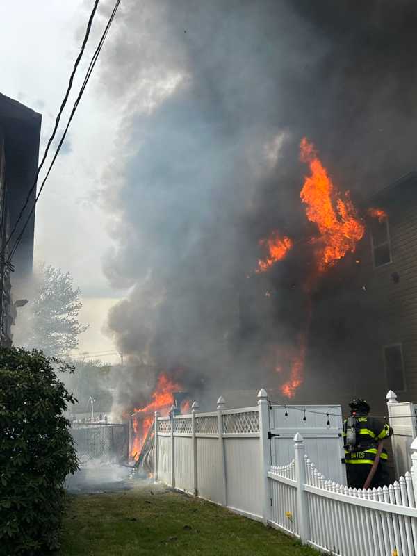 Fire Seriously Damages Home In Hudson Valley, Injures 2 Firefighters