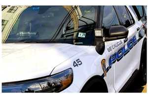 Dog Owned By Secaucus Cop Attacks Man, Pet; Chief Responds To Social Media Backlash
