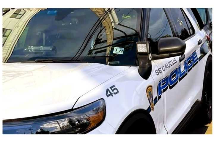 Dog Owned By Secaucus Cop Attacks Man, Pet; Chief Responds To Social Media Backlash