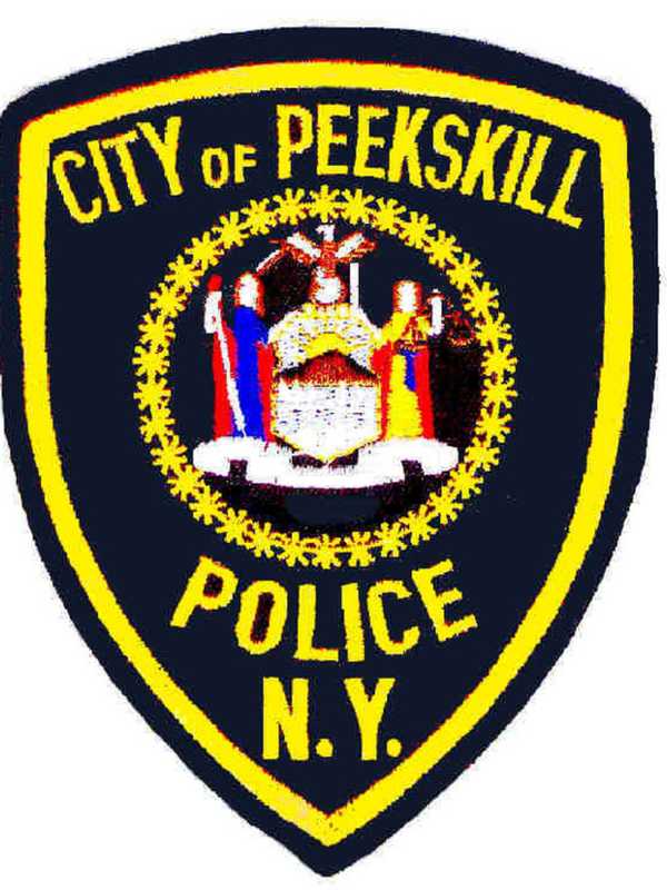 Bartender Hit In Head During Fight With Customer, Say Peekskill Police
