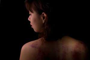 State Revises Forms To Help Victims, Officers In Domestic Violence Cases