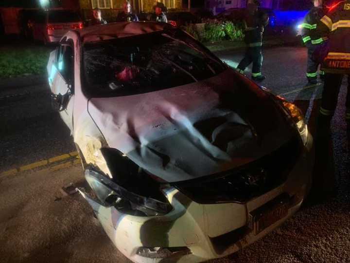 A driver was hospitalized after an overturn crash in Islip on Wednesday night.