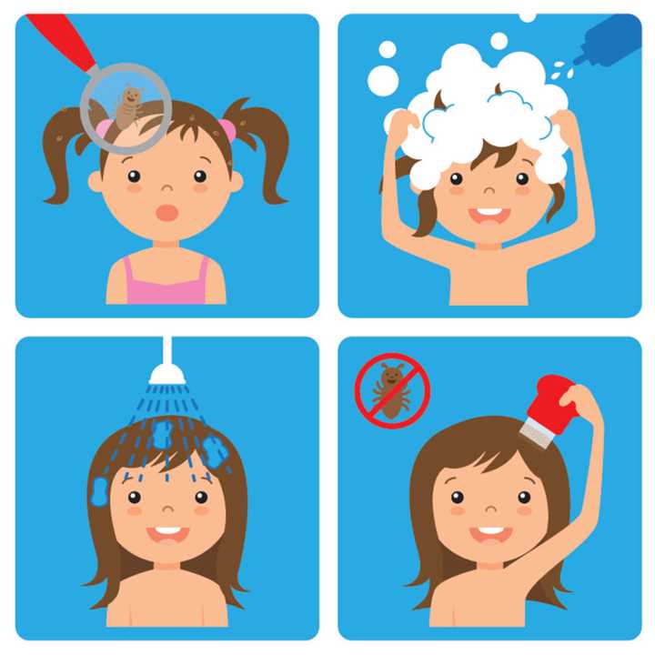 When head lice are discovered, WMC experts suggest following specific treatment steps to reduce their spread.