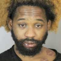 Officer Hospitalized After Struggle With LI Man Accused Of Sexually Abusing Store Employee
