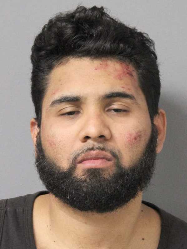 Long Island Man Nabbed For Assault After Injuring Police Officer During Arrest, Cops Say