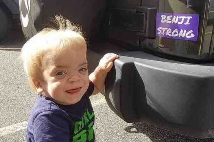 Sick New Milford Toddler Prepares For Bone Marrow Transplant
