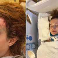 Support Swells For Sisters Injured In Bus Crash Involving Long Island HS Students
