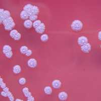 Potentially Fatal Bacteria Prompts CDC Warning