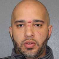 Man Arrested For Assault Following Fight With Elderly Man In Area
