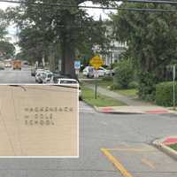 Hackensack Middle School Student Hospitalized After Colliding With SUV