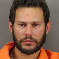 Man Attacked With Machete Loses Three Fingers, Suffers Deep Cuts, Police Say