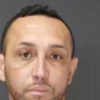 DIY DENTISTRY: Truck Driver, Assistant Severely Injure Dental ‘Patient,’ Dumont Police Charge