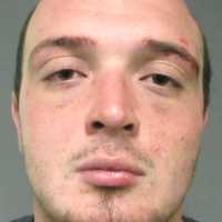Lyndhurst PD: Raging Drunk Driver Subdued After Brawl With Police