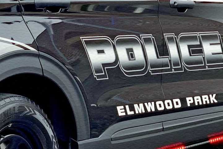 Unsupervised Boy, 4, Struck By Sedan In Elmwood Park, Child Welfare Authorities Notified