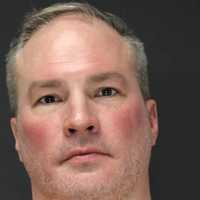 Flawed DNA Test Gets Bergen Man Doing Life For Beating, Burning Woman, 70, New Trial
