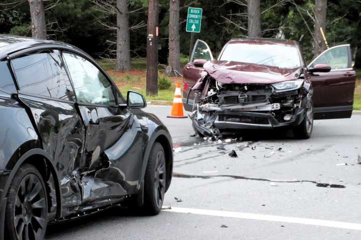 Broken Arm, Facial Injuries Reported In Paramus Crash