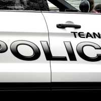 Woman Hospitalized After Horrific Fireworks Injury In Teaneck