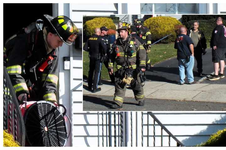 Glen Rock Homeowner Burned