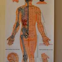 <p>Anatomical acupuncture charts are in most of the six treatment rooms at Bergen Acupuncture and Integrative Medicine in Westwood.</p>