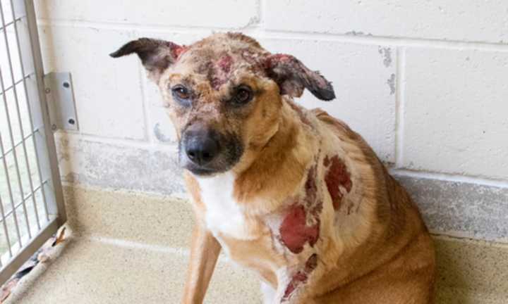 Annie was found with second-degree burns to 20% of her body