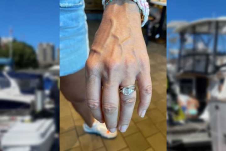 Dive Team Successfully Recovers Woman's Wedding Ring From The Charles River