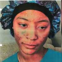 Critical Missing Baltimore Teenager Found