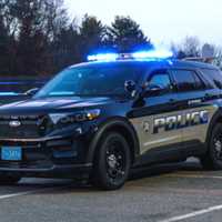 Antisemitic Slur Carved Into Car, Parts Of Home Burned In Stow: Police