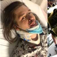 Central Mass Band Cancels Future Shows After Drummer's Brutal Attack In Boston