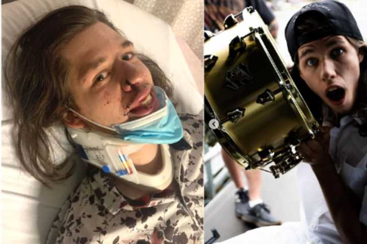 Central Mass Band Cancels Future Shows After Drummer's Brutal Attack In Boston