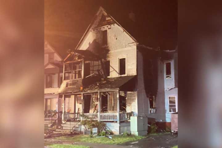 One Hospitalized, Five Displaced In Late-Night Western Mass Fire