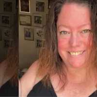 Woman Found On Park Bench Remembered As 'Ultimate Boston Girl'