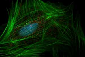 Death In Cambridge Clinical Trial May Spell End Of Biotech Company