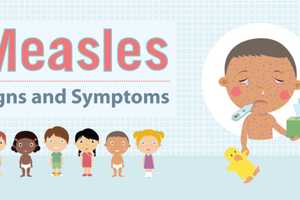 Orange County Reports Two Possible Measles Exposure Locations