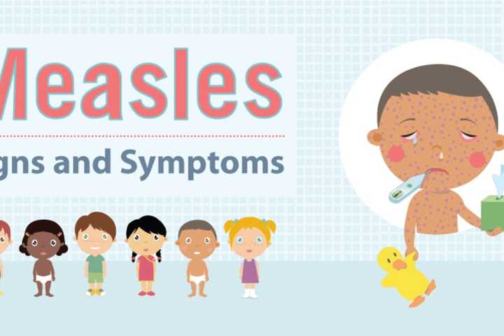 Seven New Measles Exposure Sites In Rockland Released