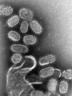 Nine New CT Flu Deaths Reported