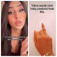 New Jersey Paraplegic, 22, Answers TikTok's Most Intimate Questions About Being Paralyzed