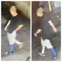 Do You Know The Man In The Cast? Central Mass Police Say He's Behind Break-in