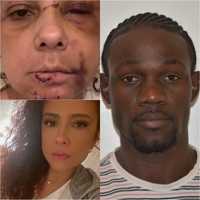 Paradise Turns Nightmare For NJ Grandmother Brutally Attacked In Turks And Caicos