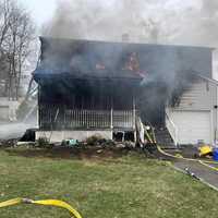 Cooking Fire Blamed For Killing Man, Injuring 2 Western Mass Firefighters