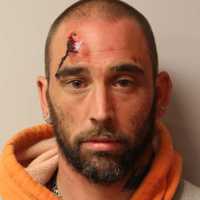 Man Threatens People With Knife In Area, Police Say