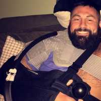 <p>Chris Della Fave&#x27;s pectoral muscle came off of the bone while he was lifting at his Hillsdale gym.</p>